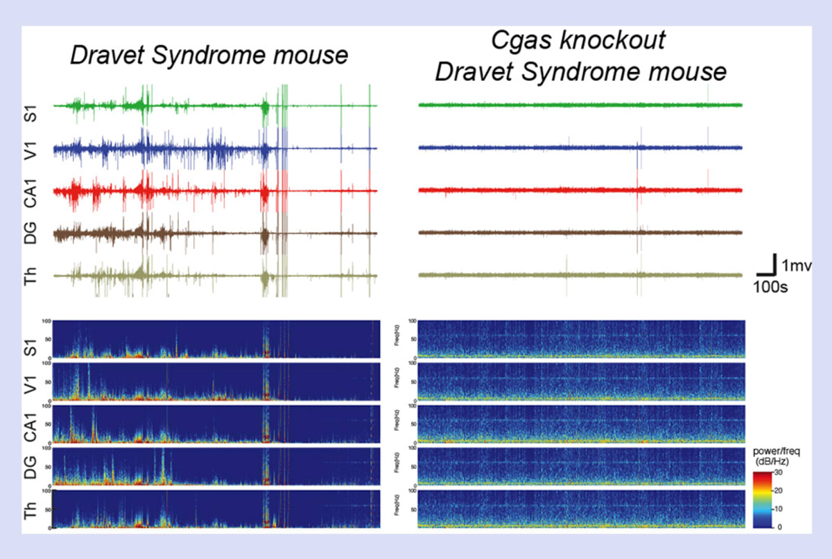 Brain activity traces comparing seizure frequency in Dravet syndrome mouse models with and without treatment