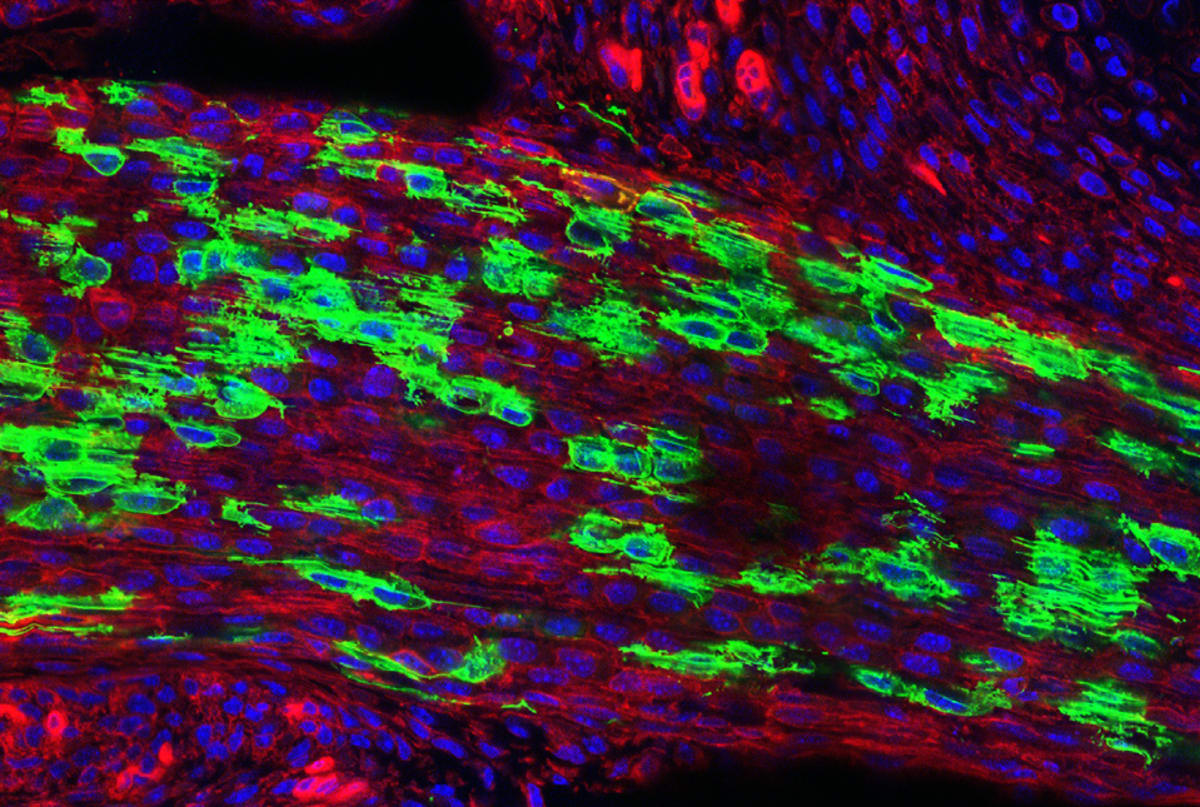 Scientists Find Stem Cells That May Treat Back Pain