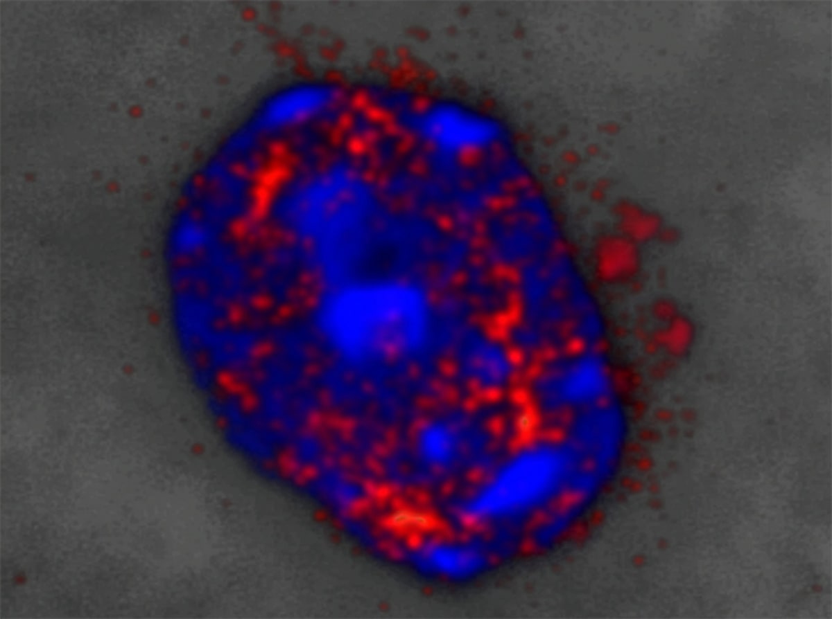 Scientists Reverse Brain Damage in Huntington's Mice - Image 3