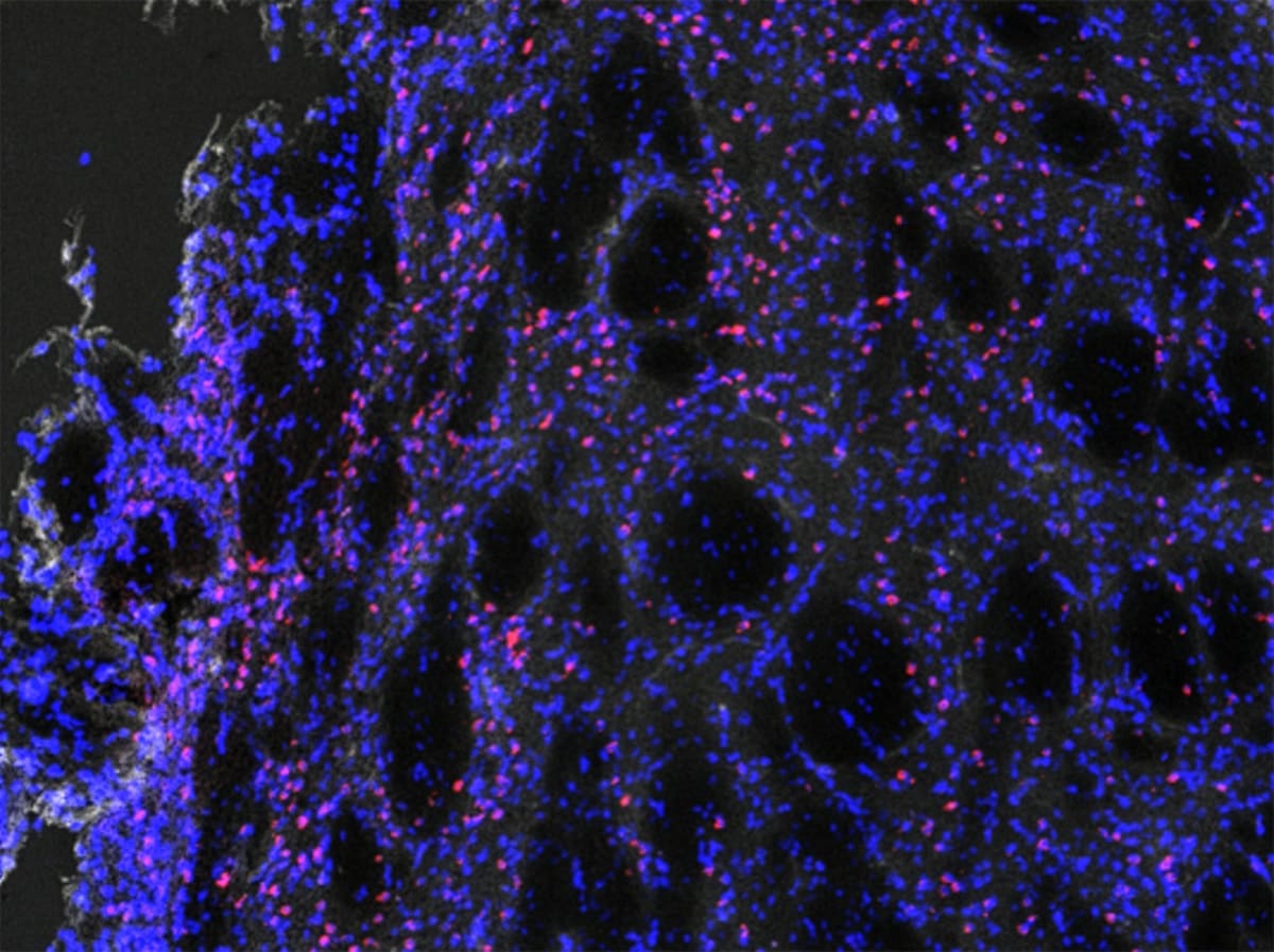 Scientists Reverse Brain Damage in Huntington's Mice - Image 2