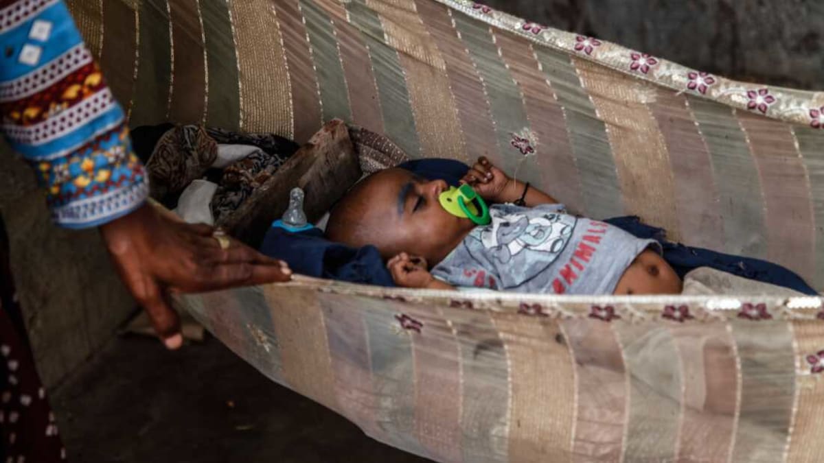 Pakistan Finds Bacteria Link to Premature Birth Risk - Image 4