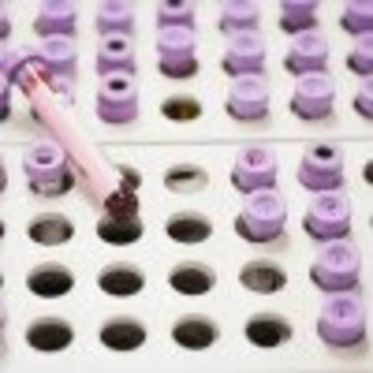 Healthcare provider administering shingles vaccine injection to patient's arm in clinical setting