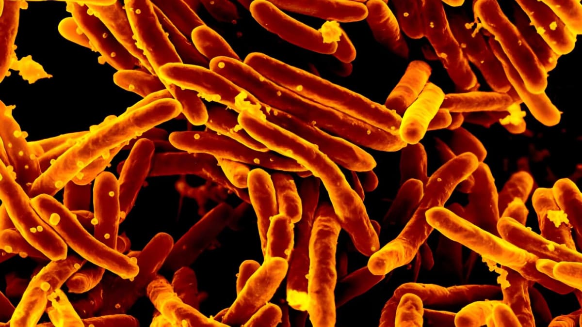 Scanning electron microscope image showing rod-shaped tuberculosis bacteria in orange and yellow tones
