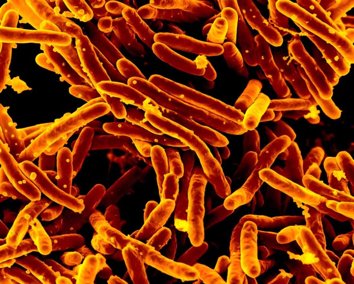 New $3 TB Test Works With Tongue Swab, Saves Lives - Image 3