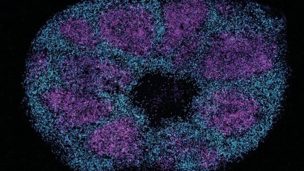 Scientists Map Autism Proteins, Open Path to New Treatments