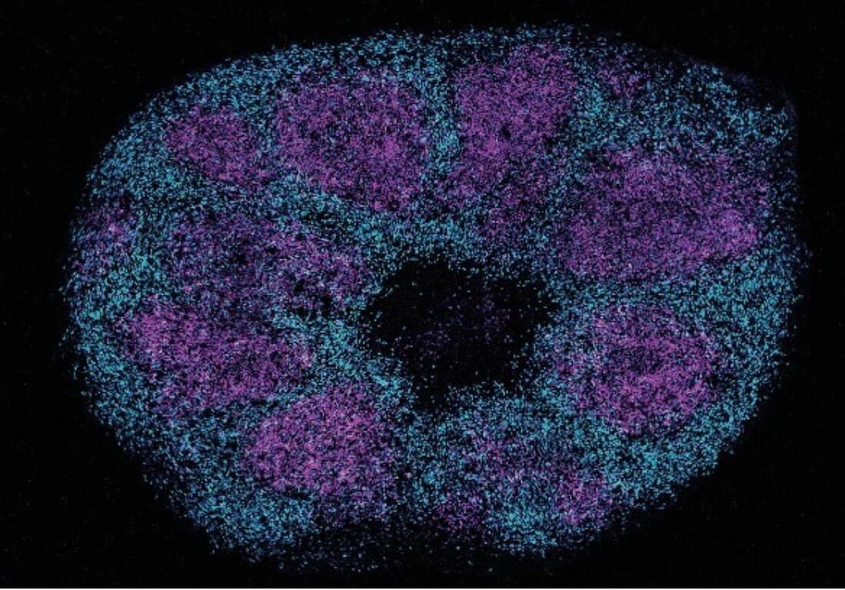 Scientists Map Autism Proteins, Open Path to New Treatments - Image 3