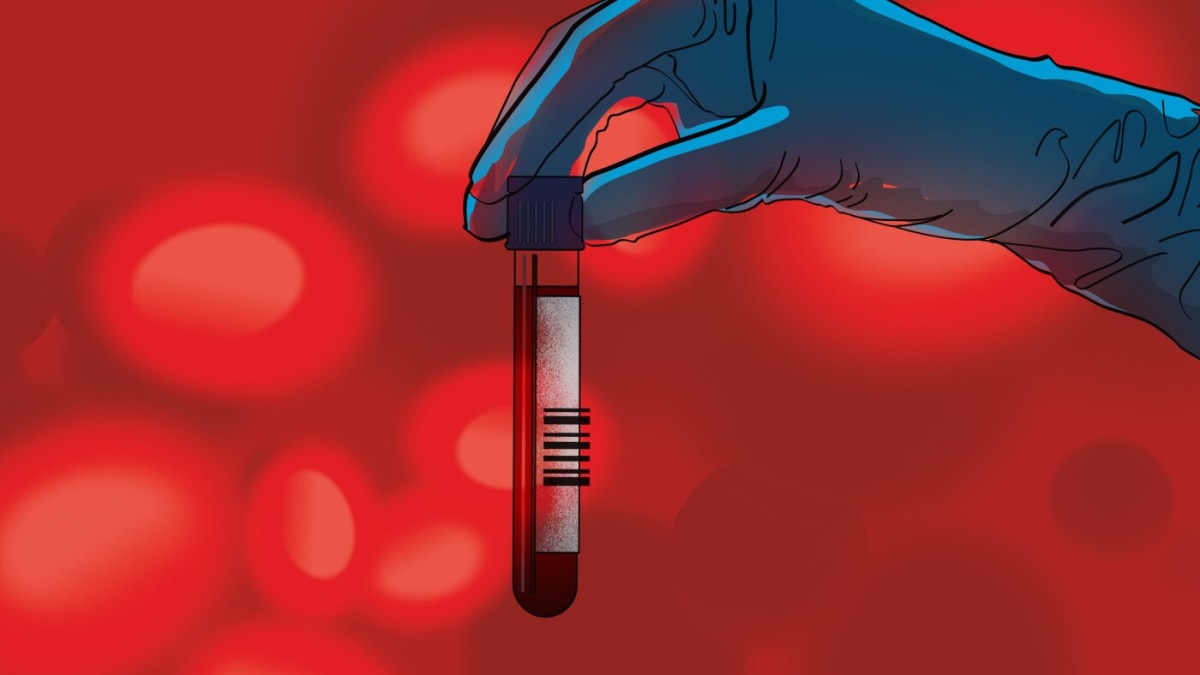Blood Test Detects 50 Cancers in One Vial