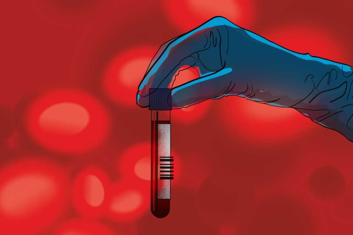 Blood Test Detects 50 Cancers in One Vial - Image 3
