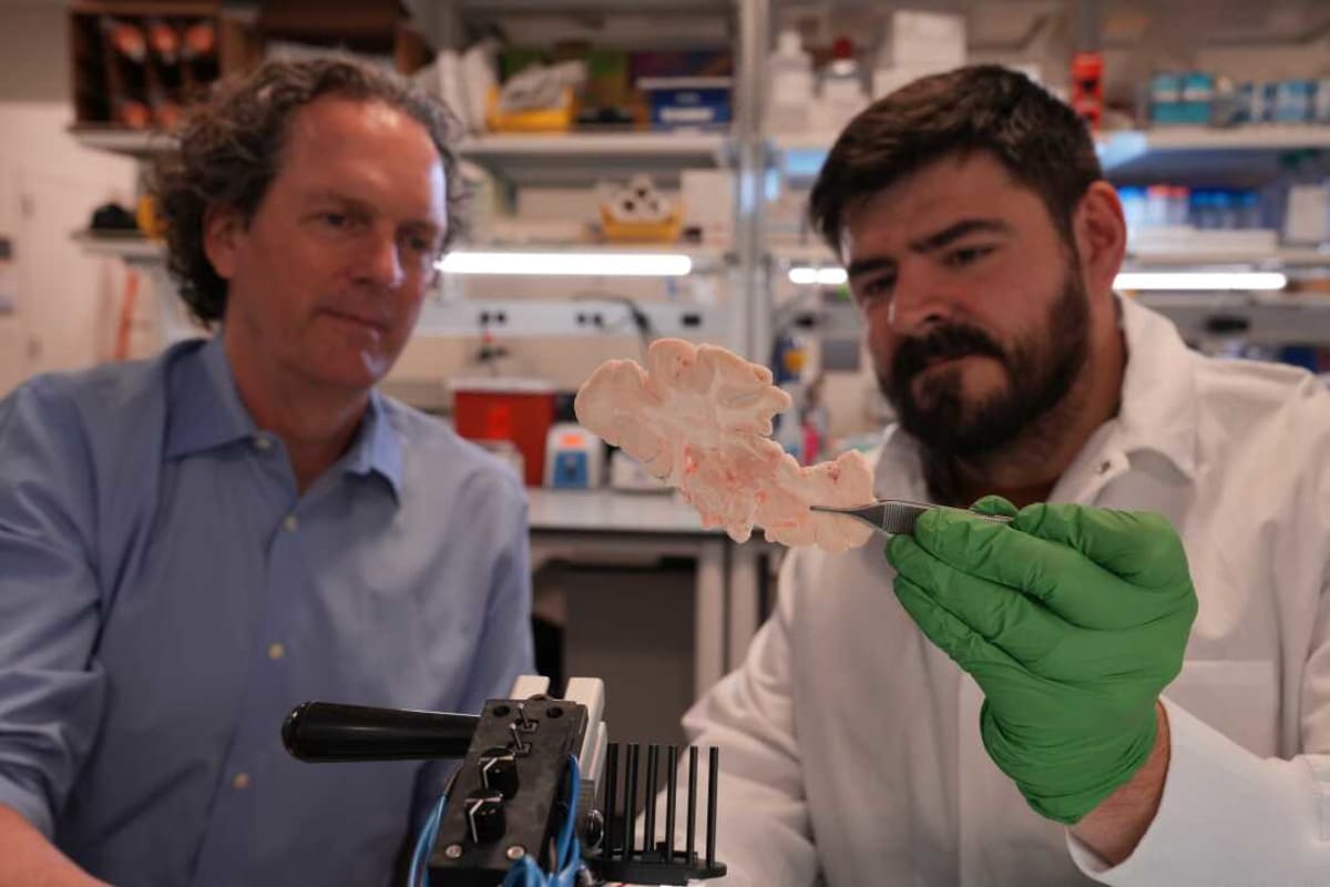 Scientists Ready to Fix Brain Diseases Like Alzheimer's - Image 4