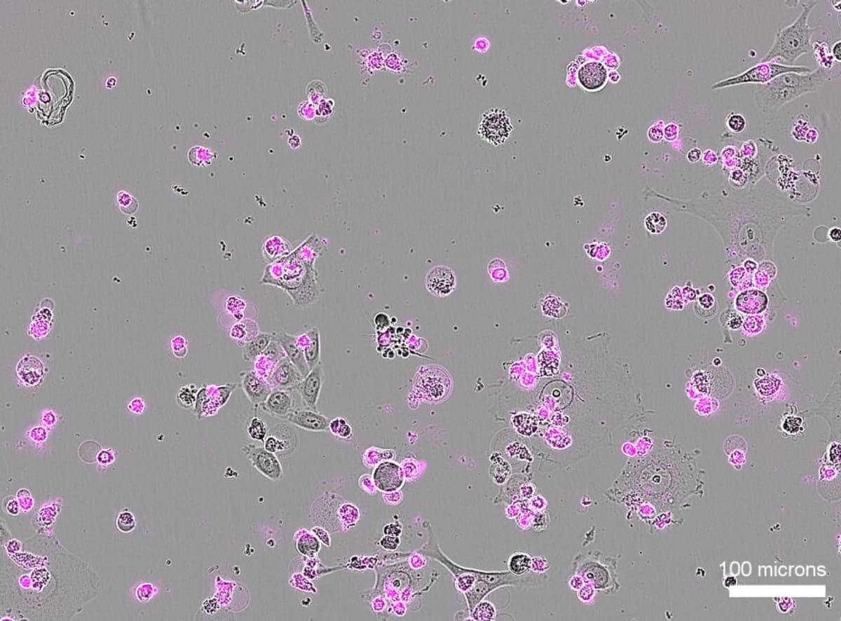 Cave Bacteria Could Target Cancer Cells Without Side Effects - Image 4