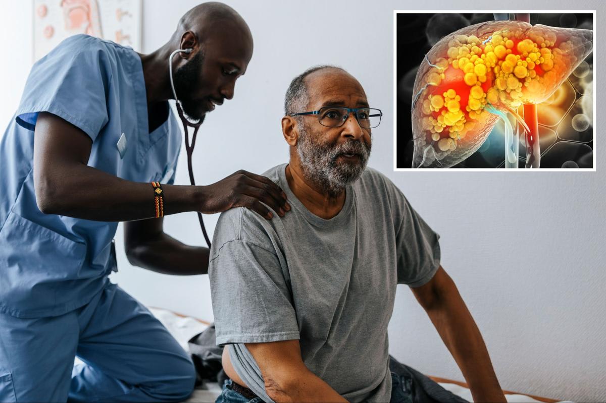 UCLA Scientists Reverse Fatty Liver Disease in Breakthrough