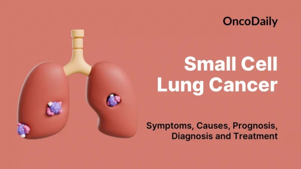 Europe Backs 2 New Lung Cancer Treatments for Patients - Image 3