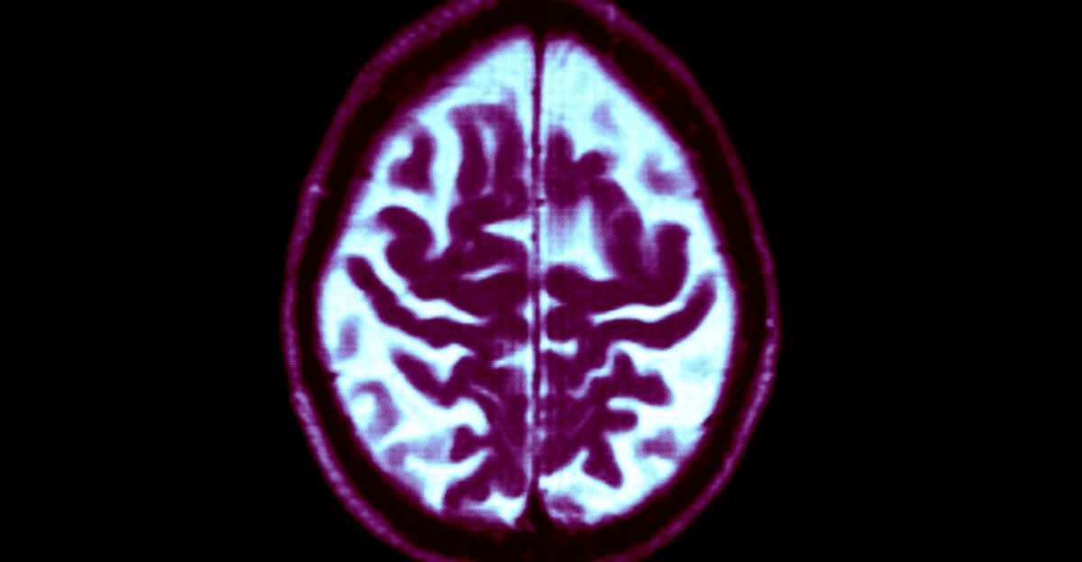 Dementia Risk Drops 13% Per Decade Since 1988