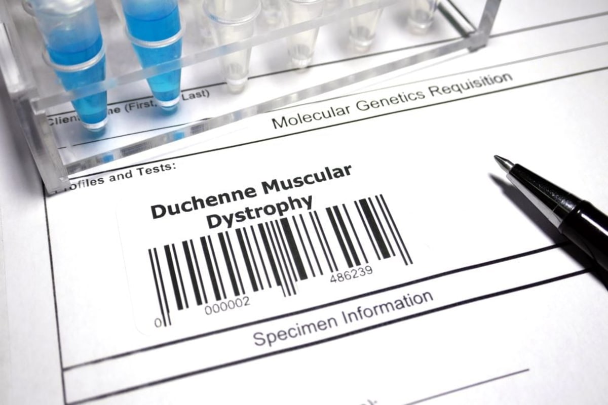 CureDuchenne Raises $50M to Find Cure for Boys With DMD