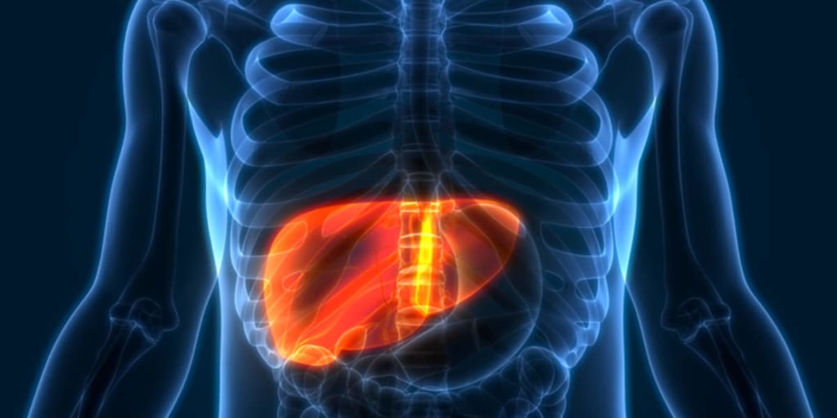 New Liver Cancer Treatment Cuts Wait Times for Patients - Image 2