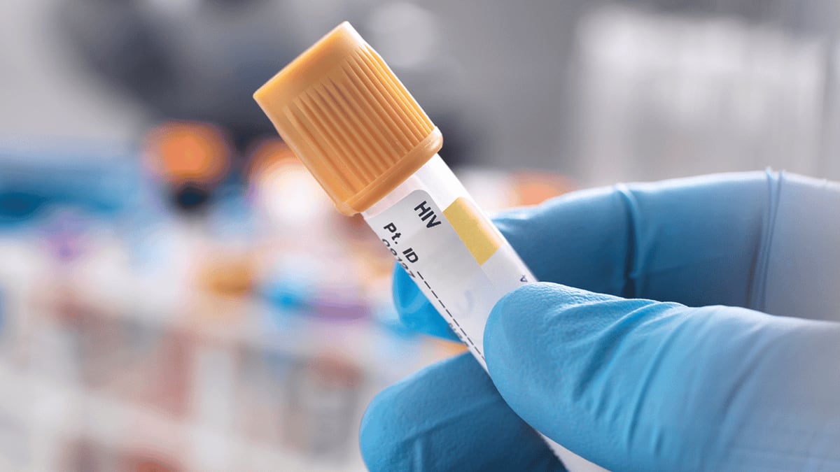 Oslo Man Cured of HIV After Brother's Stem Cell Donation