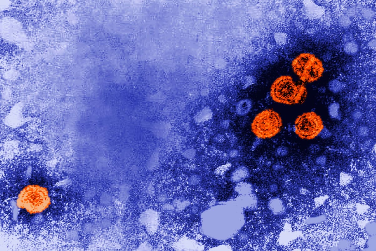 Electron microscope image showing orange hepatitis B virus particles from Centers for Disease Control