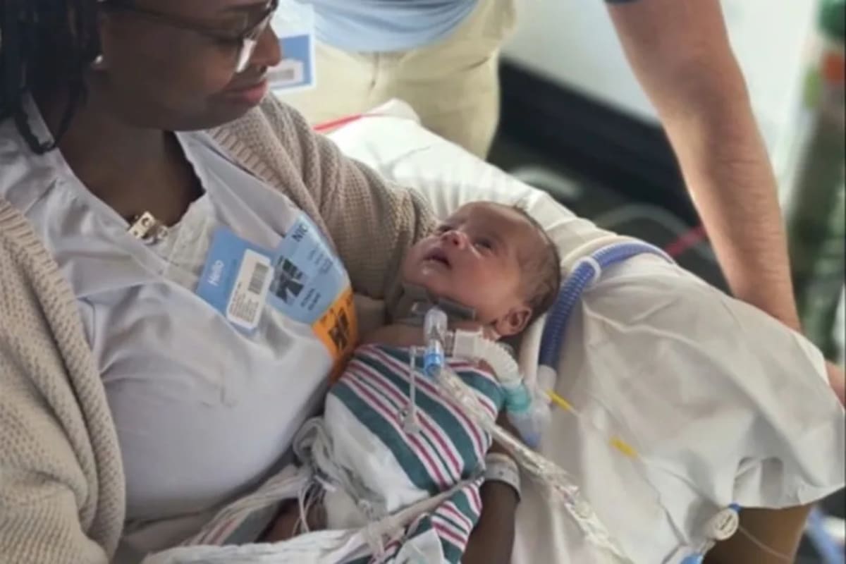 Baby Born Twice Survives Rare Surgery at 25 Weeks - Image 5