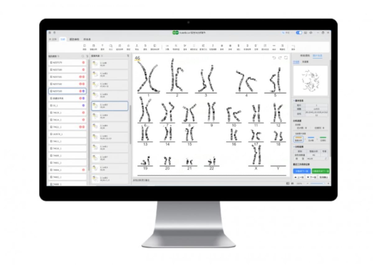 Medical professional reviewing AI-generated chromosome analysis results on computer screen in modern laboratory