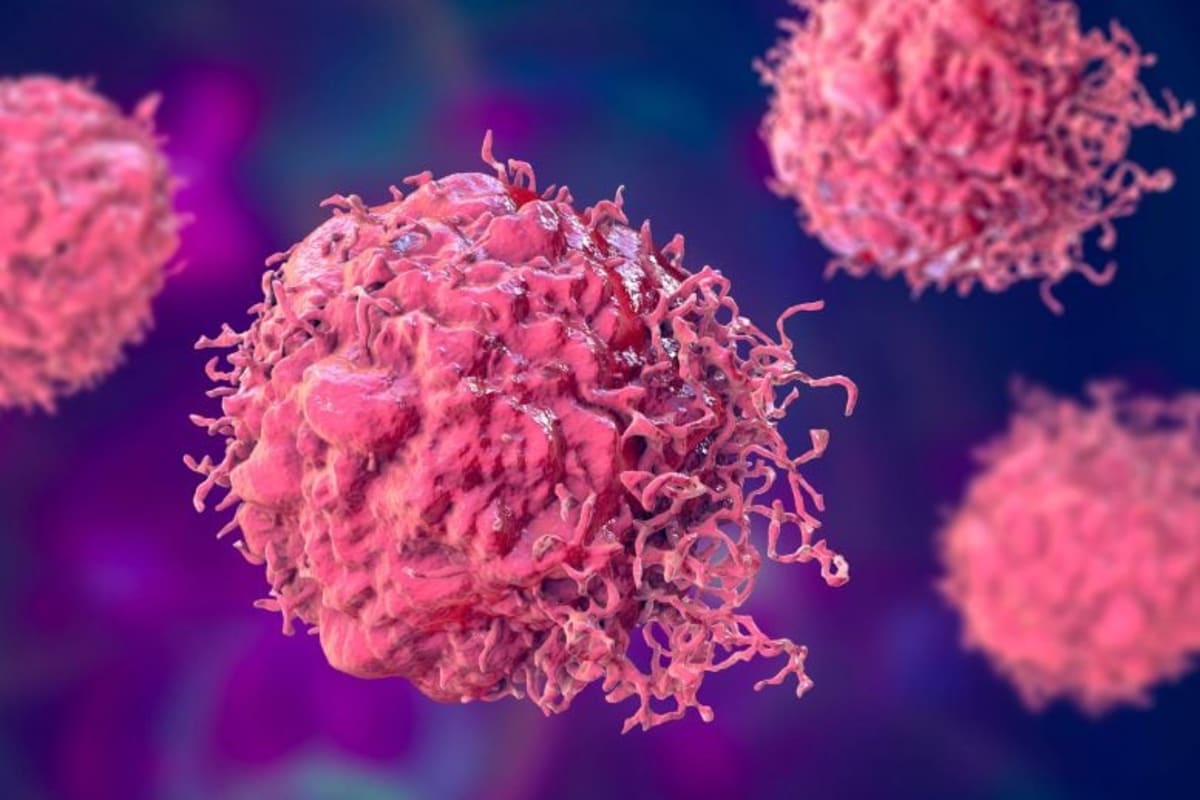 Scientists Make Pancreatic Cancer Visible to Immune System