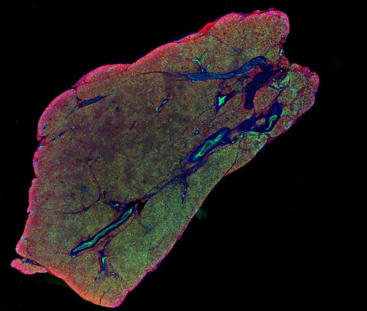 Scientists Find Protein That Supercharges Calorie-Burning Fat - Image 3