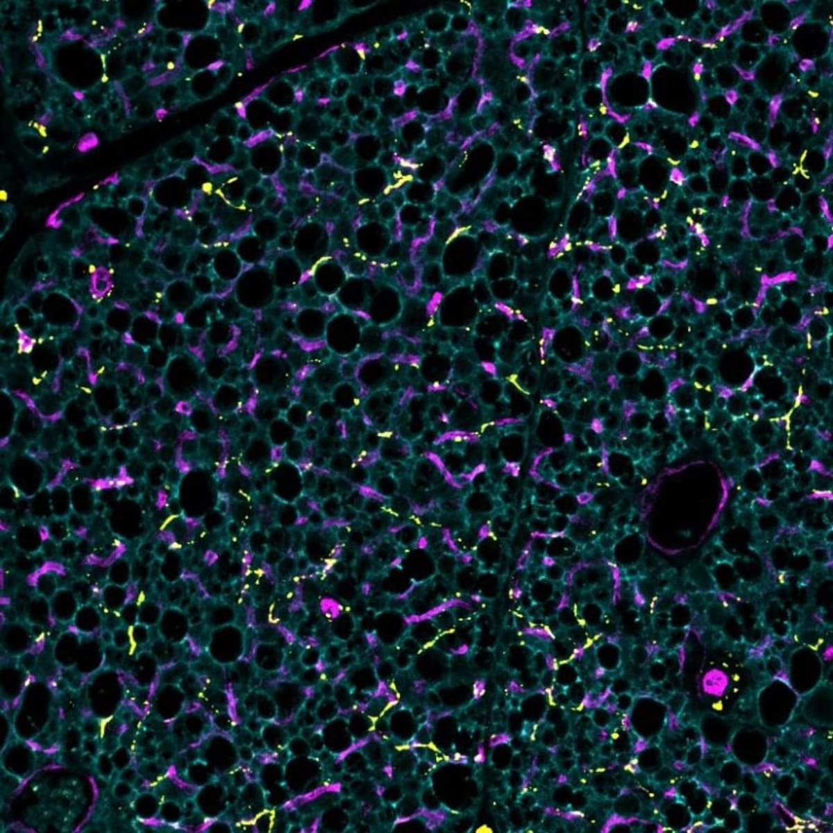 Scientists Find Protein That Supercharges Calorie-Burning Fat - Image 5