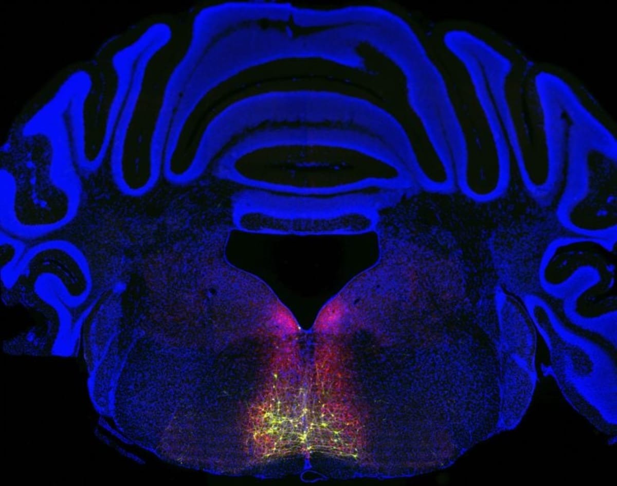 Stanford Finds Brain Circuit That Could End Chronic Pain - Image 3