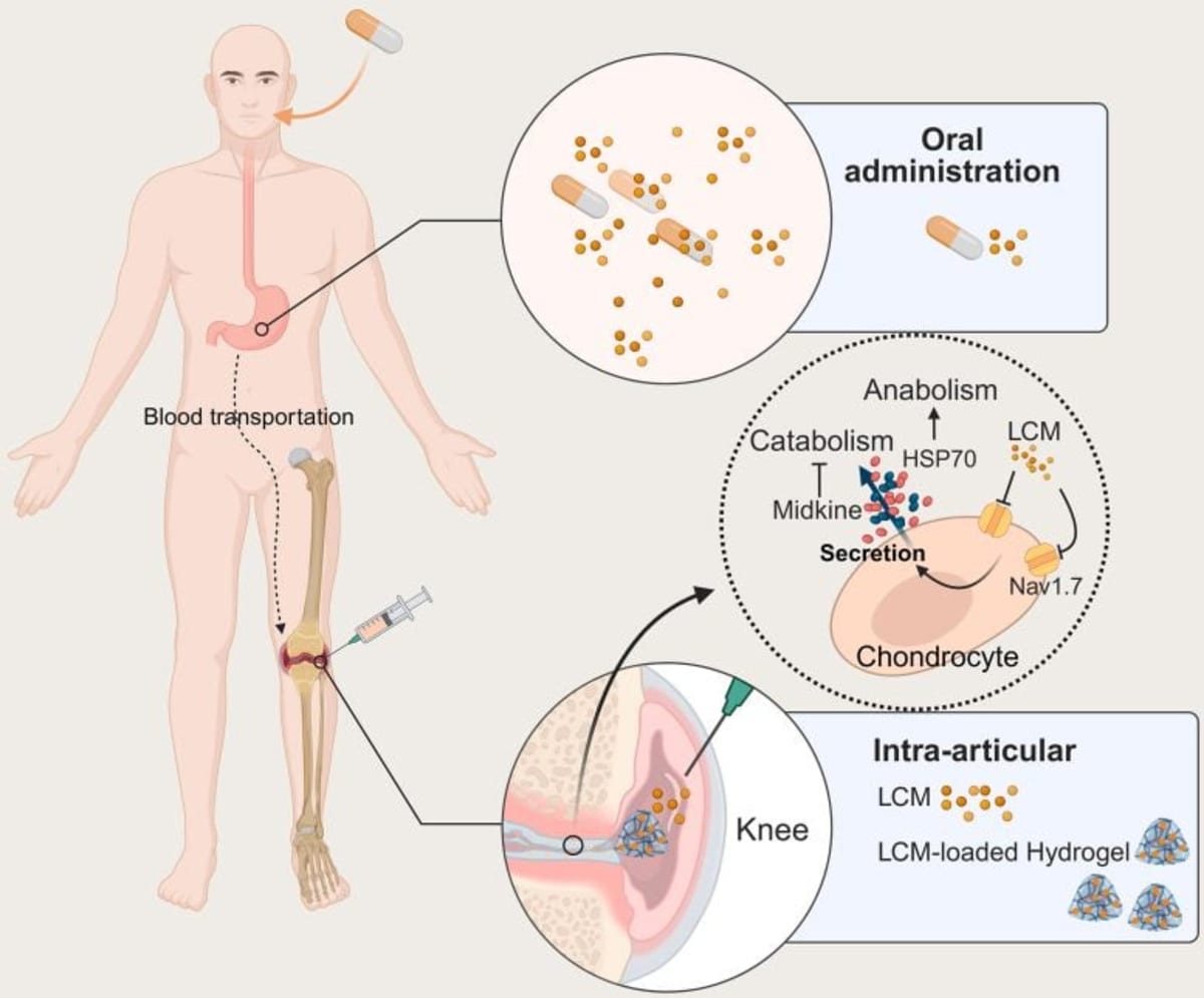 Yale Finds Epilepsy Drug Repairs Osteoarthritis Cartilage - Image 2