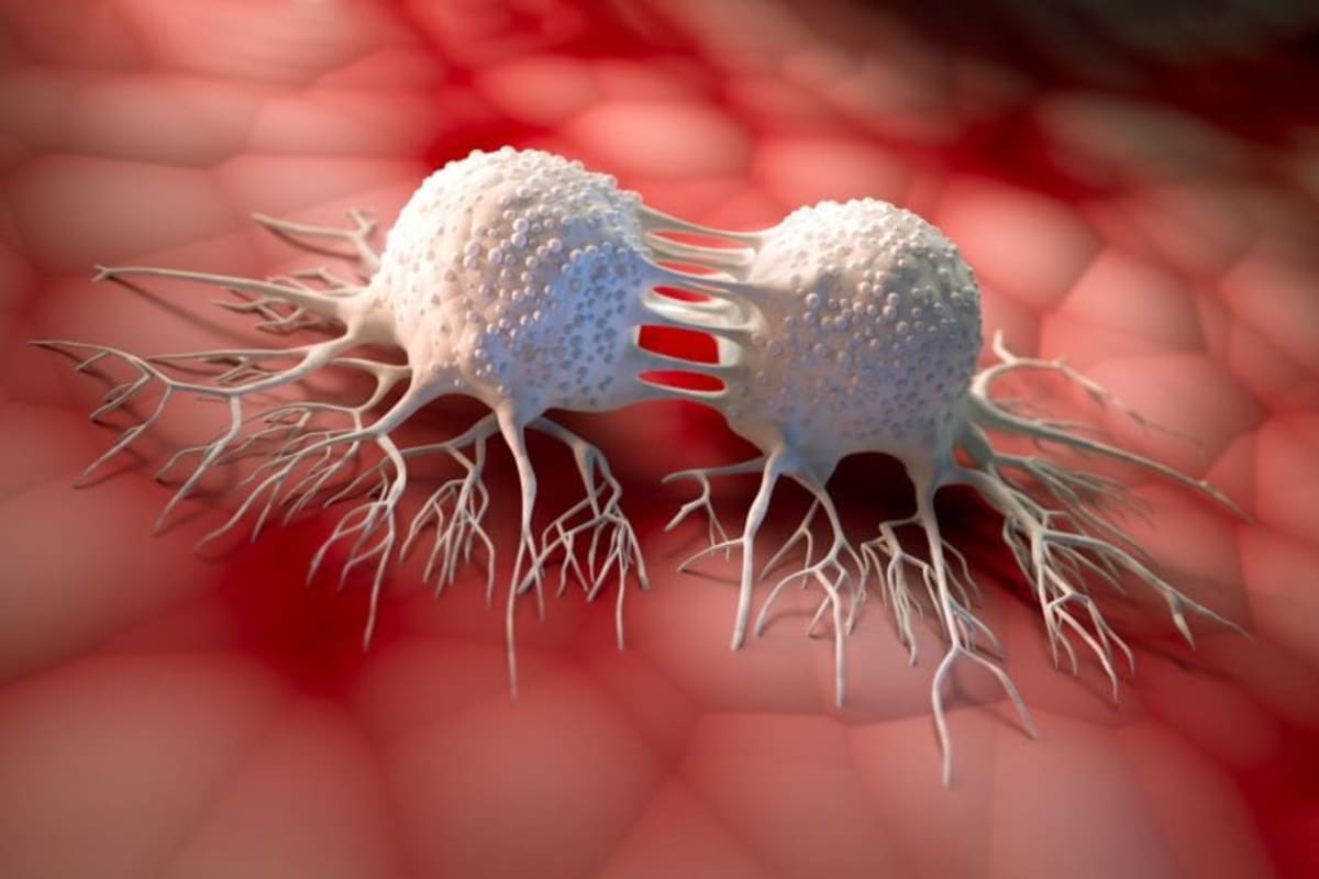 New Drug CS18 Helps Cancer Cells Vulnerable to Treatment