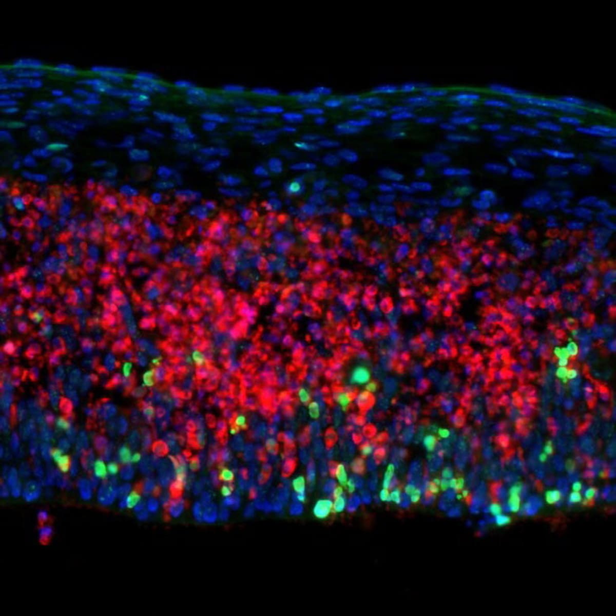 Scientists Find New Way to Protect MS Patients' Brains - Image 3