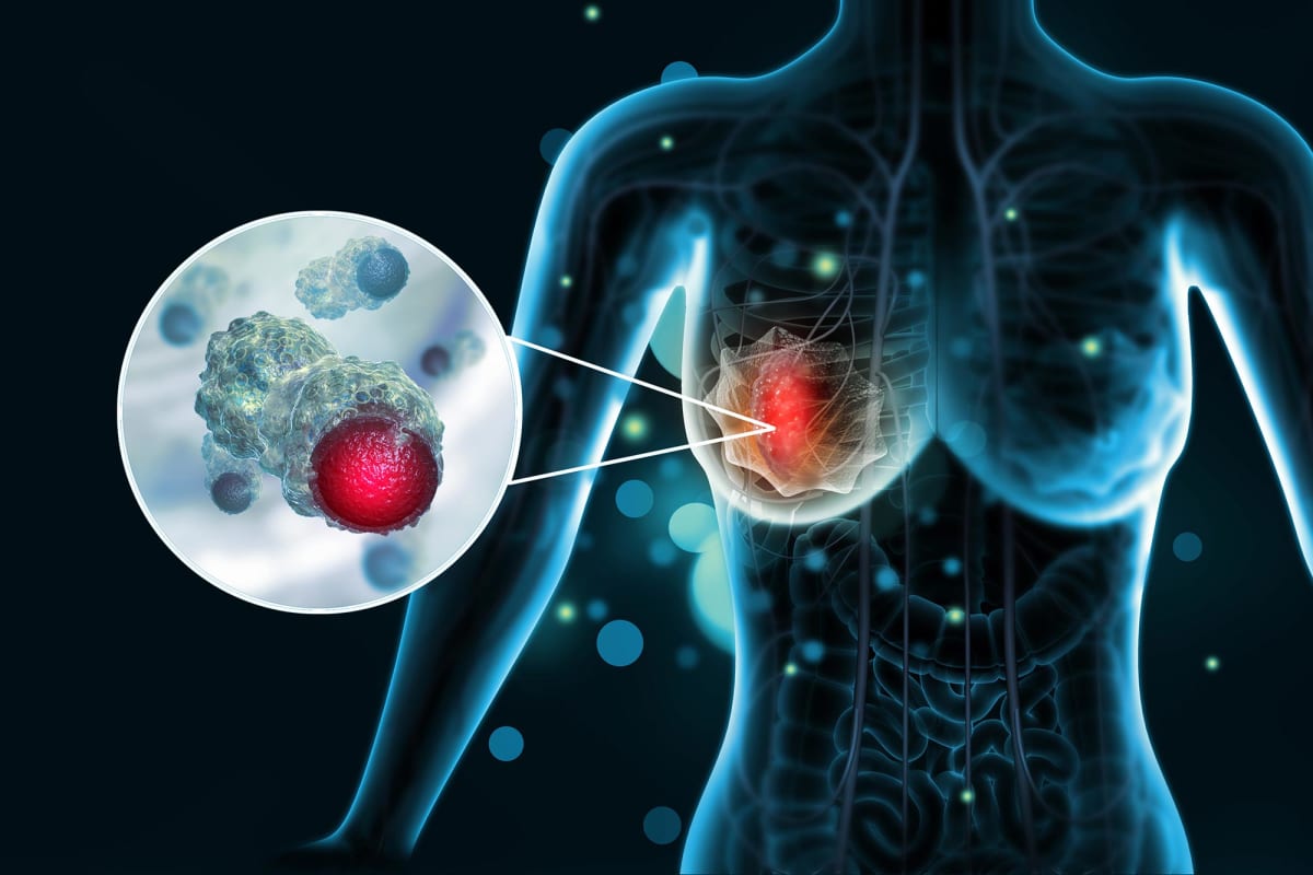 Molecular illustration showing breast cancer cell receptors being separated by peptide treatment