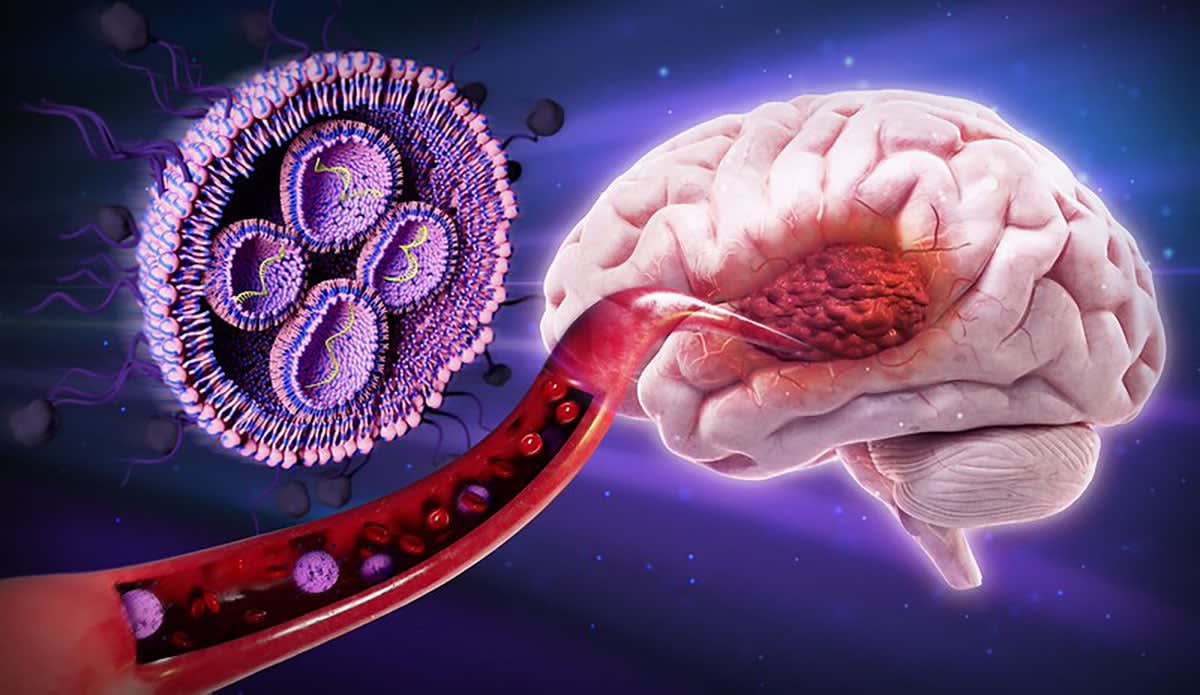 Sugar-Coated Nanoparticles Extend Brain Cancer Survival 50%