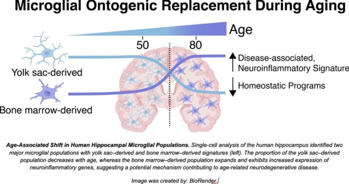 Brain Enters New Phase Between Ages 50 and 75 - Image 3