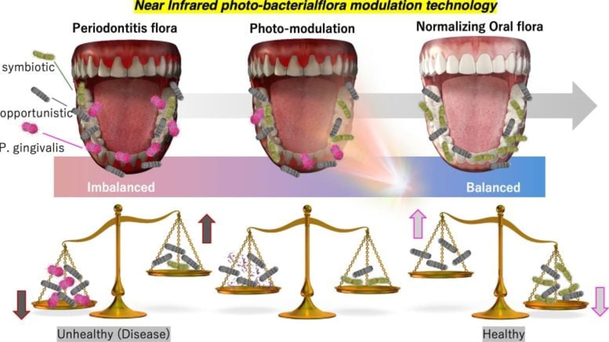 New Light Therapy Treats Gum Disease, Keeps Good Bacteria - Image 2