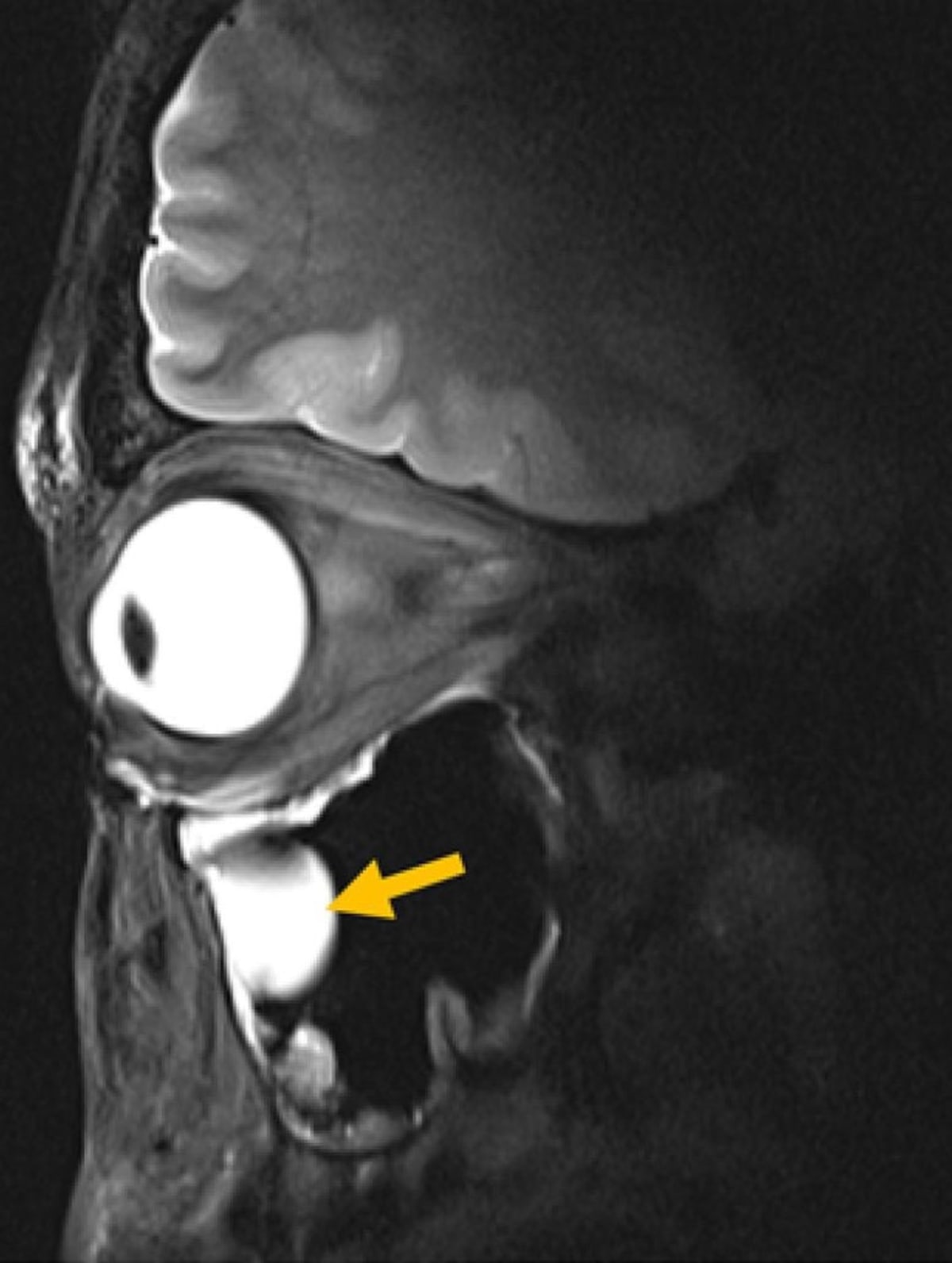 New MRI Antenna Reveals Brain and Eye in Stunning Detail - Image 4
