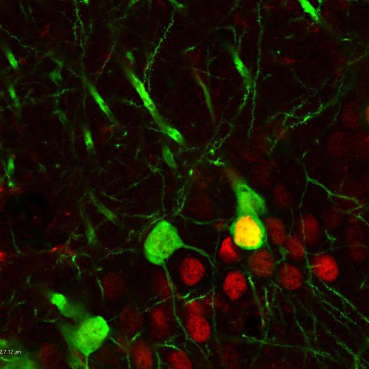 Scientists Find Brain Switch Behind Cocaine Addiction - Image 3