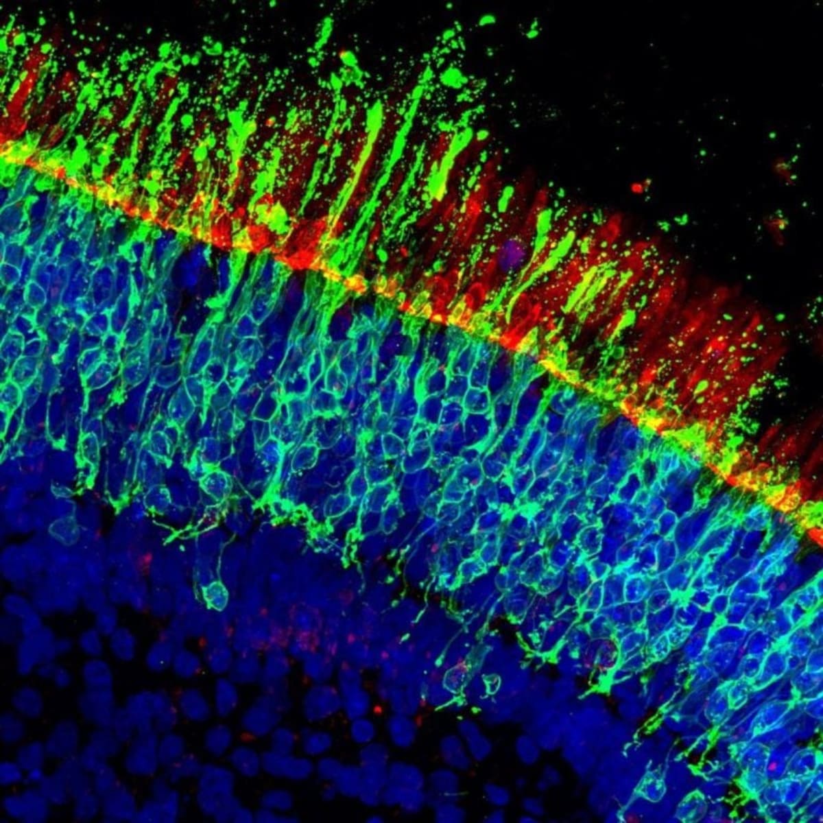 Scientists Find Way to Stop Common Vision Loss - Image 2