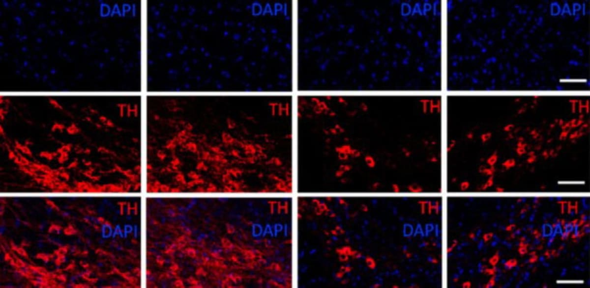 Brazil Scientists Find Peptide That Protects Brain Cells - Image 3