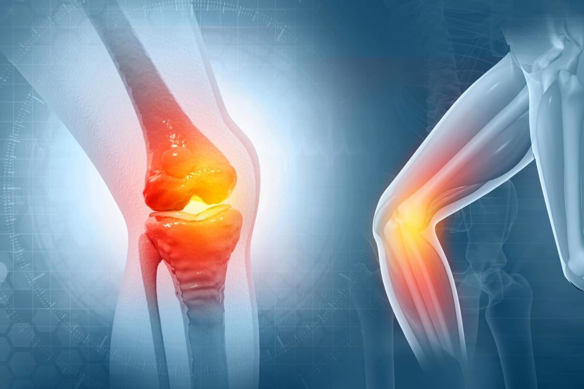 Researcher in laboratory working on experimental osteoarthritis treatments that regenerate damaged joints