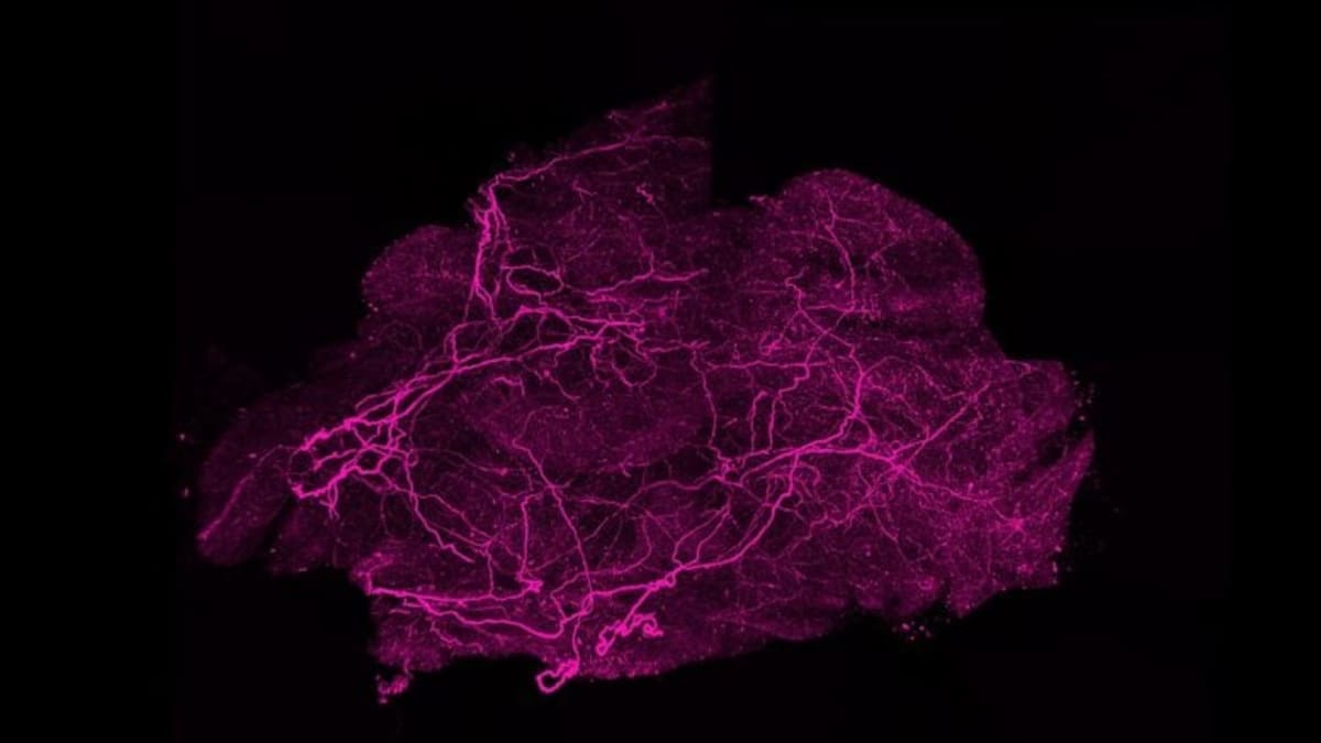 Scientists Find Protein That Supercharges Calorie-Burning Fat - Image 4