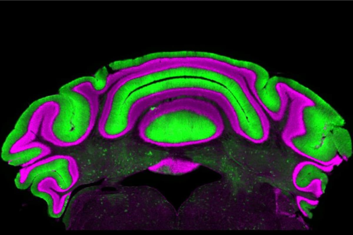 Virginia Tech Finds Key to Better Movement Disorder Cures - Image 2