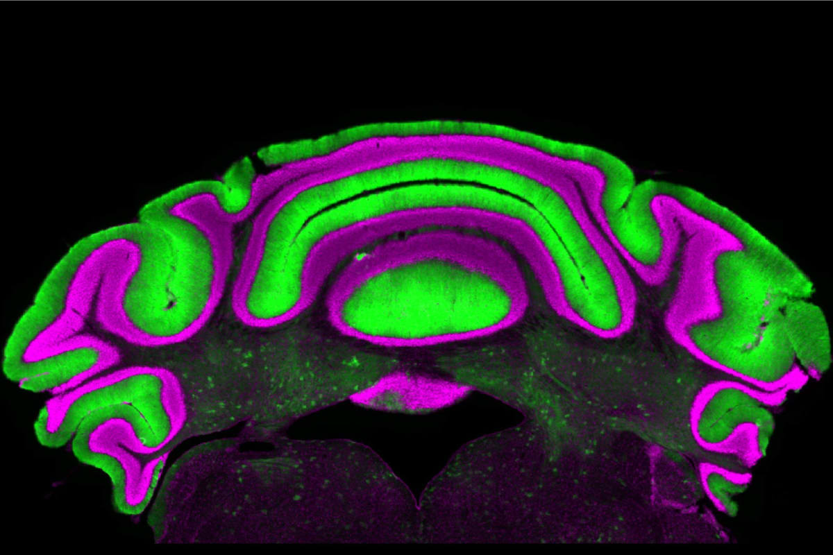 Green-stained Purkinje cells in cerebellum tissue showing brain regions that control movement coordination