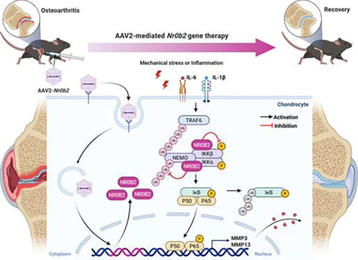 Scientists Find Protein That Could Stop Arthritis Damage - Image 4