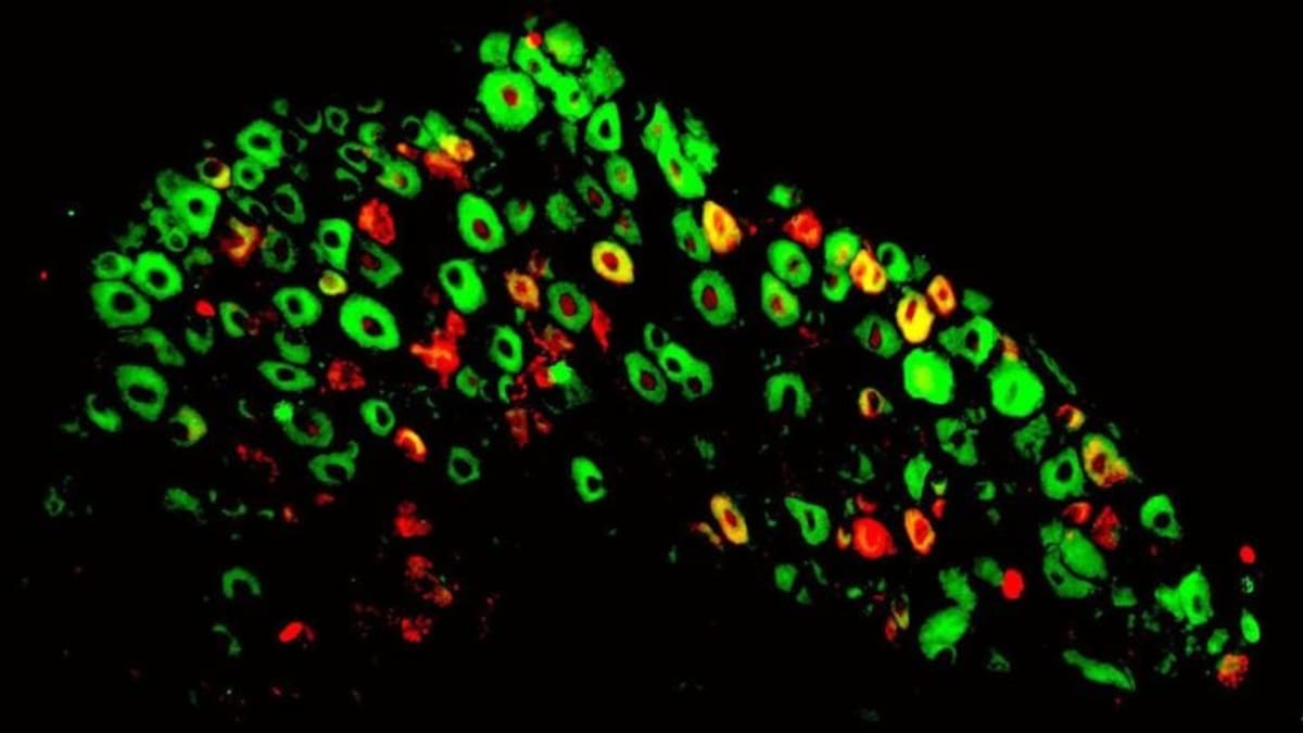 Cancer Drug Cuts Chronic Nerve Pain in Breakthrough Study - Image 3