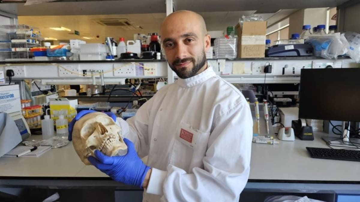 Scientists Turn Wool Into Better Bone-Healing Material - Image 3