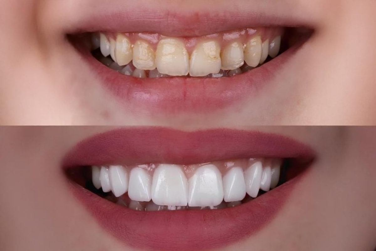 UT Dallas Prints Perfect Dental Crowns in 30 Minutes - Image 2