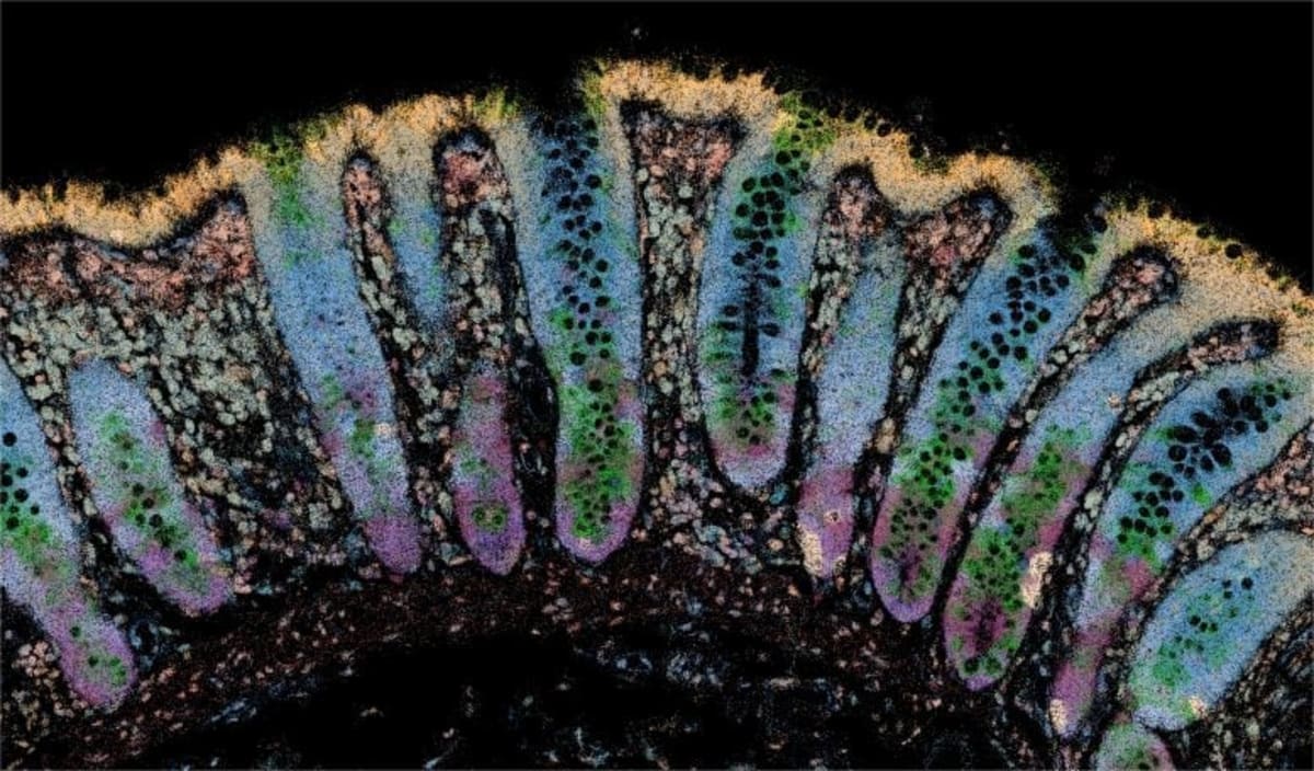 IBD Breakthrough: Scientists Find Why Flare-Ups Return - Image 2