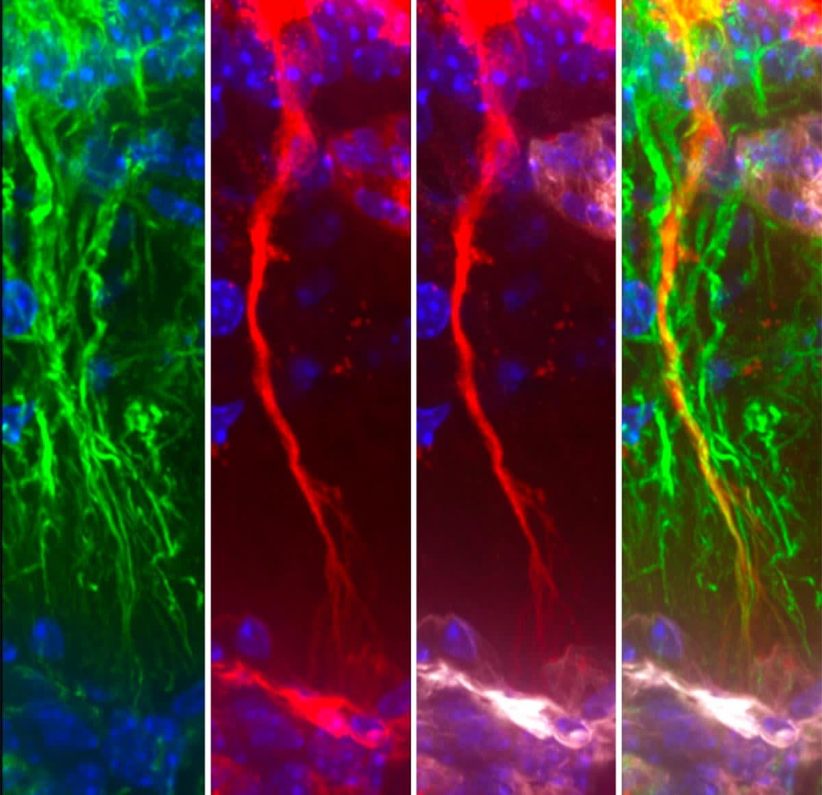 Brain's Cleanup Cells May Hold Key to Alzheimer's