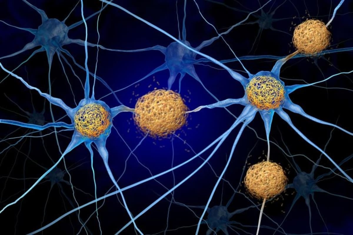 Alzheimer's Protein Tau Actually Helps Build Lasting Memories - Image 2
