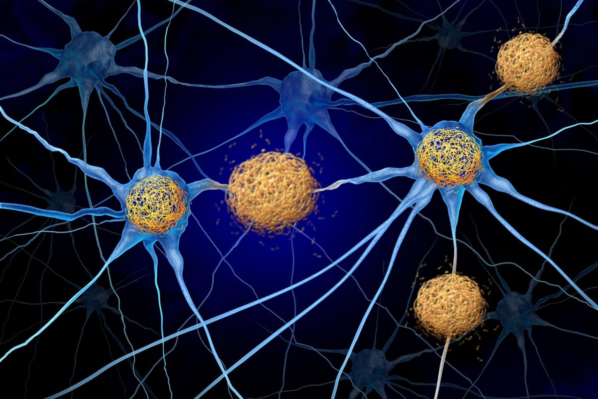 Microscopic view of brain neurons connecting to form memory pathways in healthy tissue